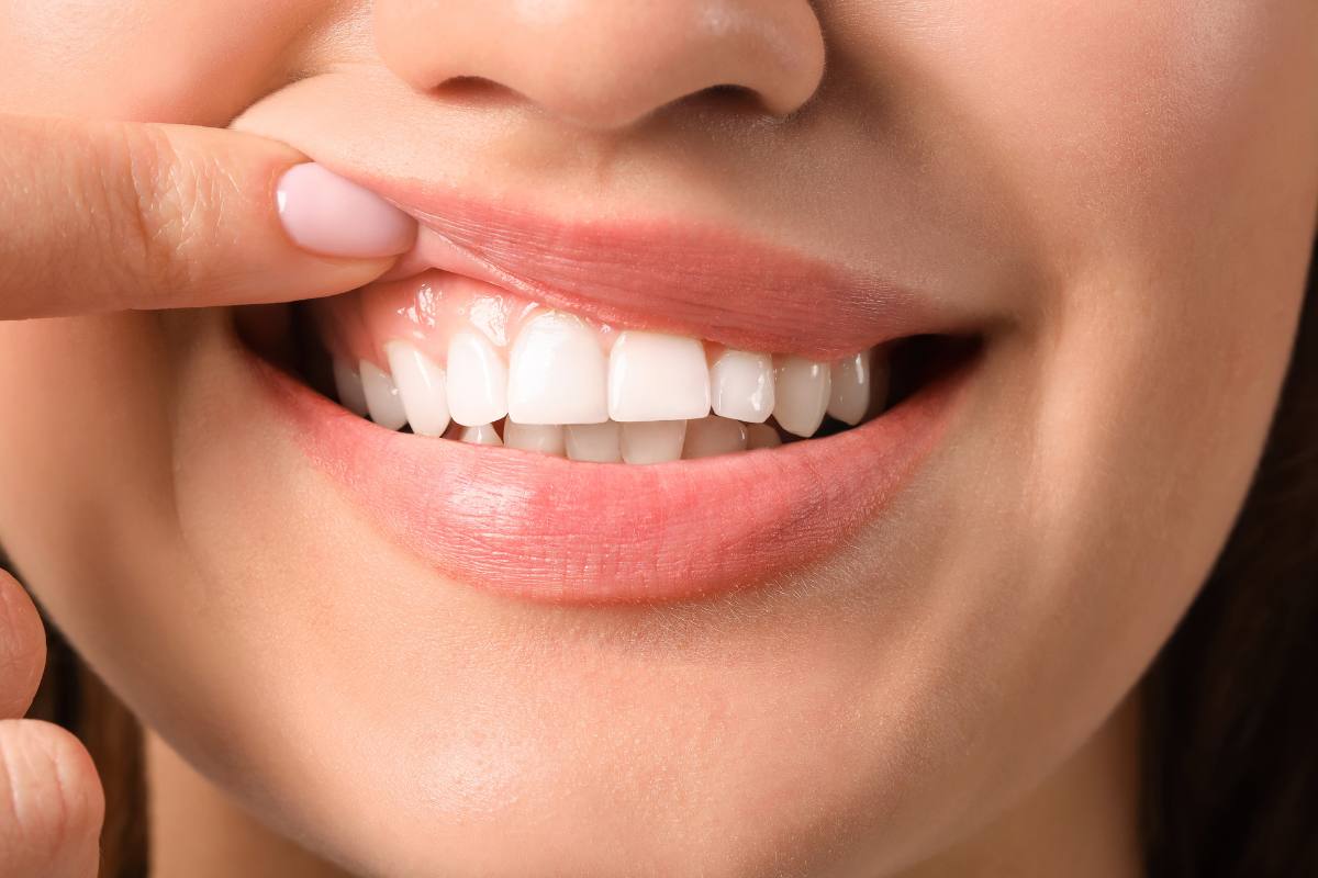 Foods That Love Your Smile: A Nutritional Guide for Healthy Teeth and Gums
